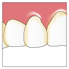予防歯科3