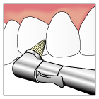 予防歯科4